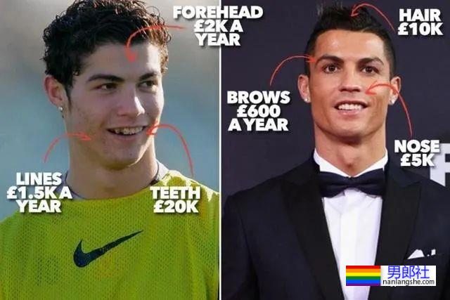 C罗竟然往那里注射肉毒？？这得多疼啊…… - 51虹马