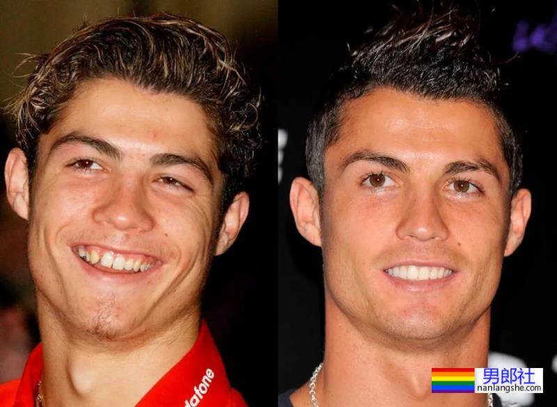 C罗竟然往那里注射肉毒？？这得多疼啊…… - 51虹马