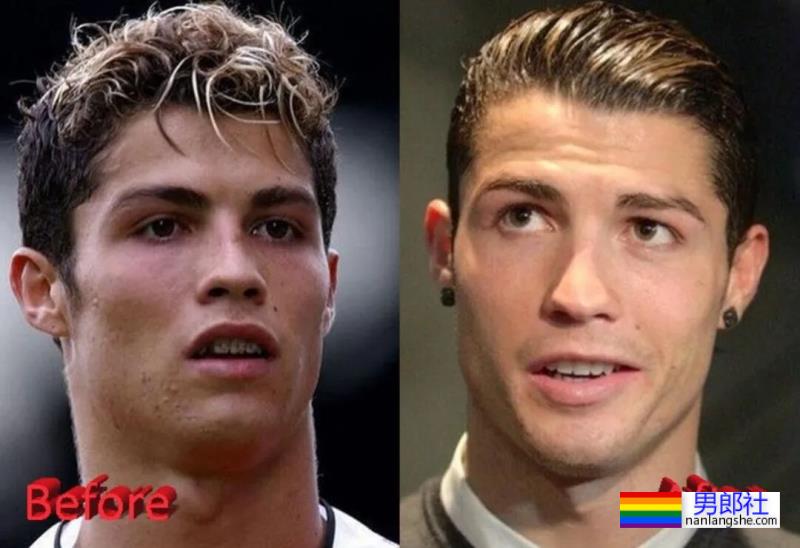 C罗竟然往那里注射肉毒？？这得多疼啊…… - 51虹马