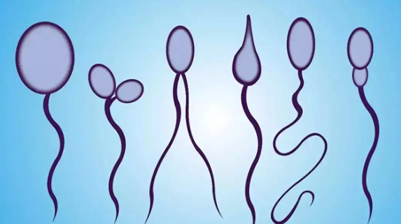 口述:去医院化验精液的经历 - 51虹马 口述:去医院化验精液的经历 - 51虹马