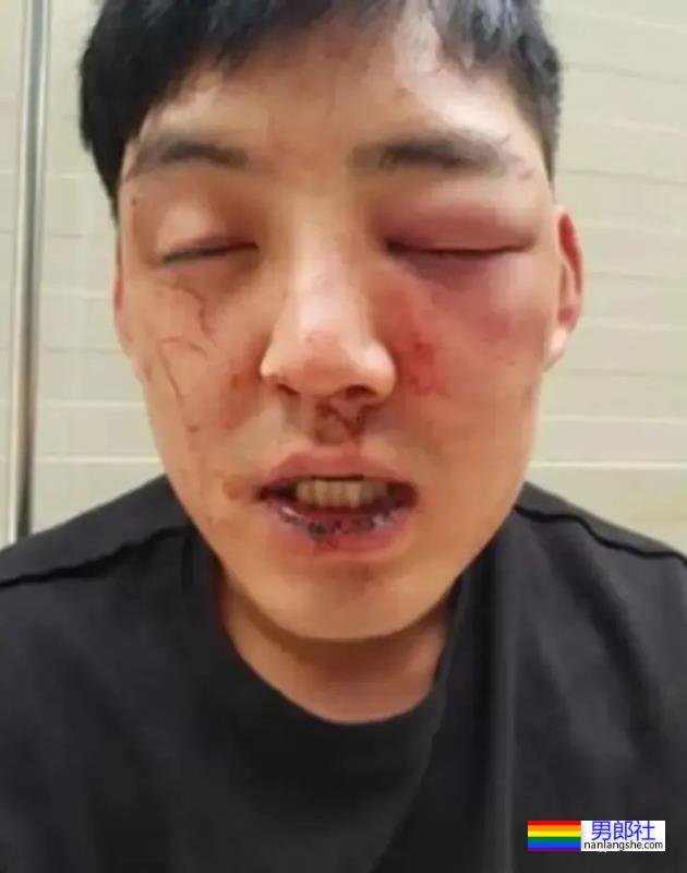 肌肉男网红被抓了，打残帅哥弟弟侵犯员工？他到底在发什么疯…… - 51虹马